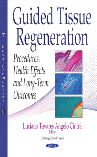 Guided tissue regeneration : procedures, health effects and long-term outcomes