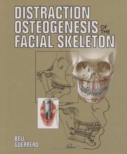 Distraction Osteogenesis of the Facial Skeleton [With CDROM]