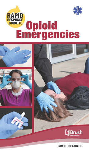 Rapid response guide to opioid emergencies