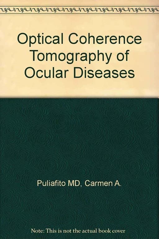 Optical Coherence Tomography of Ocular Diseases