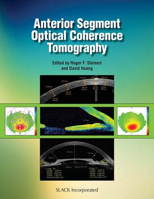 Anterior Segment Optical Coherence Tomography