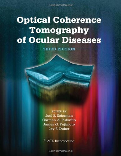 Optical Coherence Tomography of Ocular Diseases