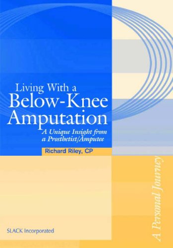 Living with a below-knee amputation : a unique insight from a prosthetist/amputee