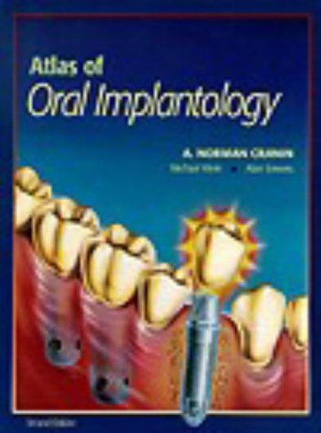 Atlas Of Oral Implantology