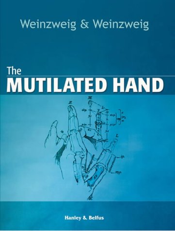 The Mutilated Hand