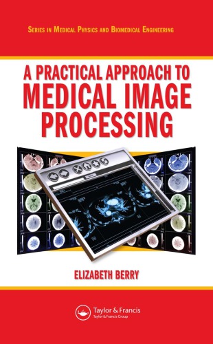 Practical Approach to Medical Image Processing.