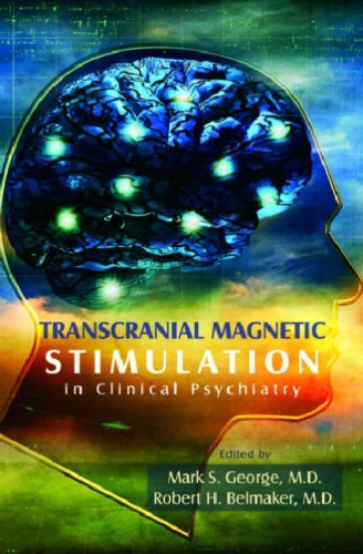 Transcranial Magnetic Stimulation in Clinical Psychiatry