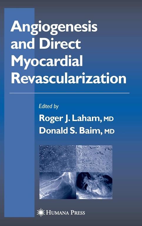 Angiogenesis and Direct Myocardial Revascularization