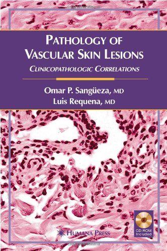 Pathology of Vascular Skin Lesions