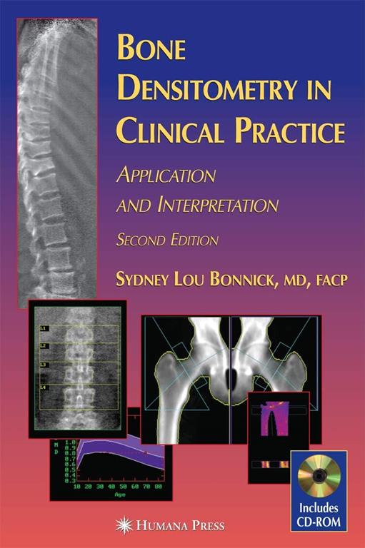 Bone Densitometry in Clinical Practice: Application and Interpretation (Current Clinical Practice)