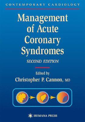 Management of Acute Coronary Syndromes