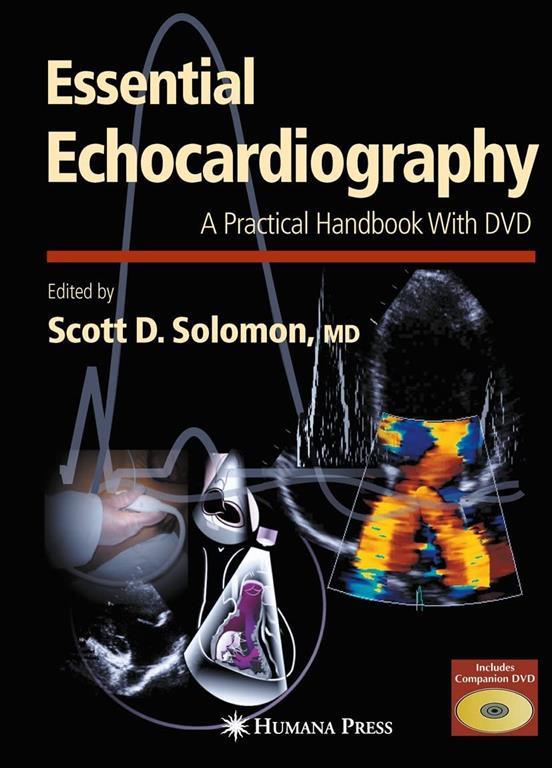 Essential Echocardiography