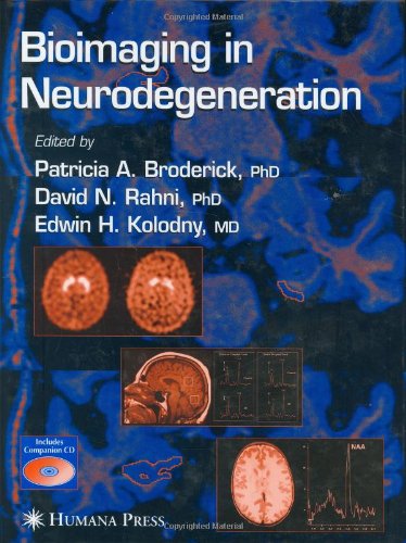 Bioimaging in Neurodegeneration