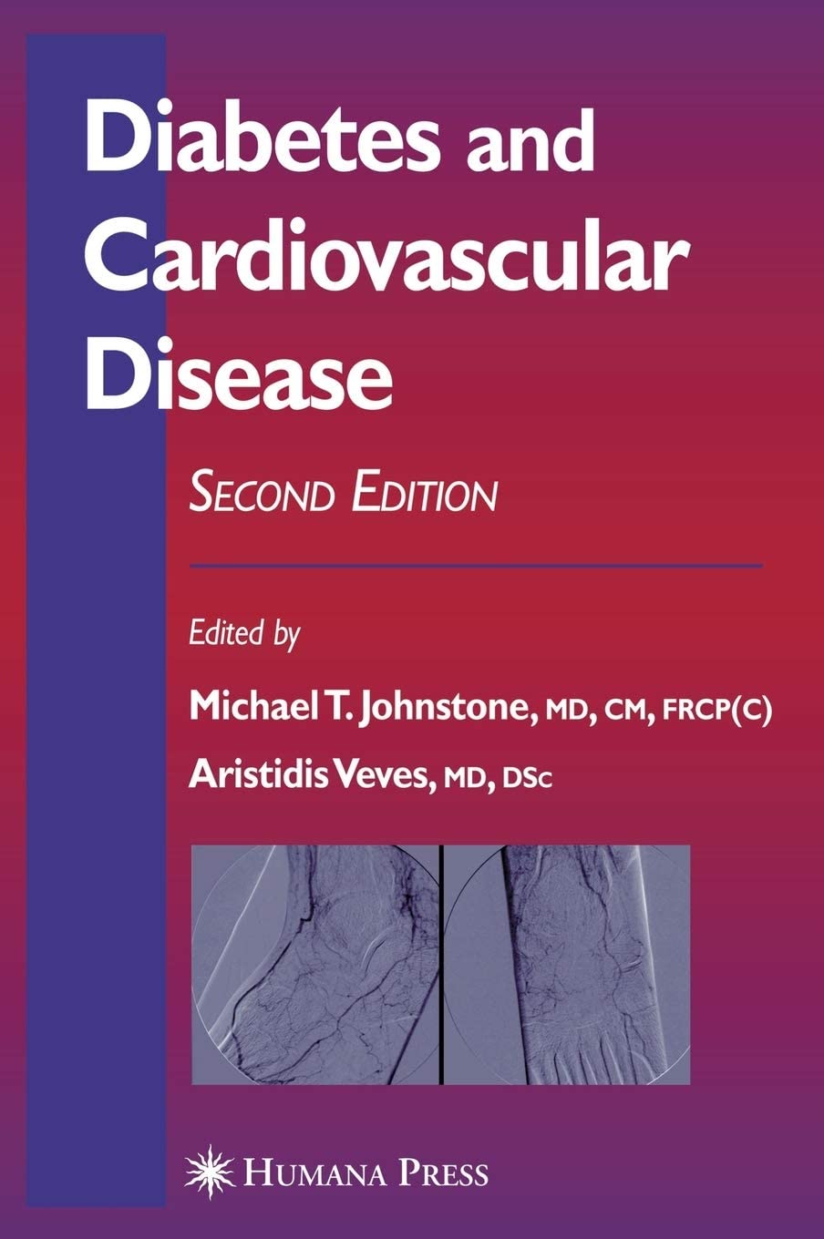 Diabetes and Cardiovascular Disease (Contemporary Cardiology)