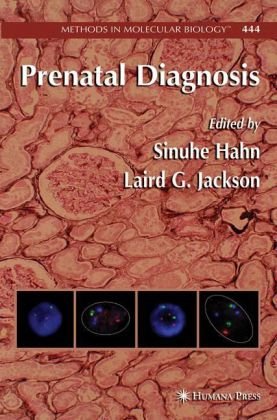 Prenatal Diagnosis