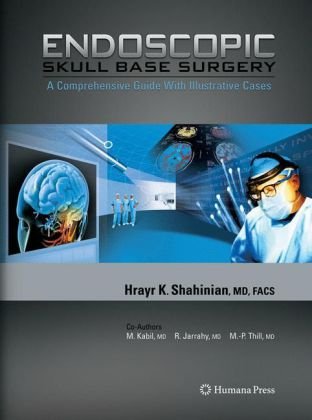 Endoscopic Skull Base Surgery