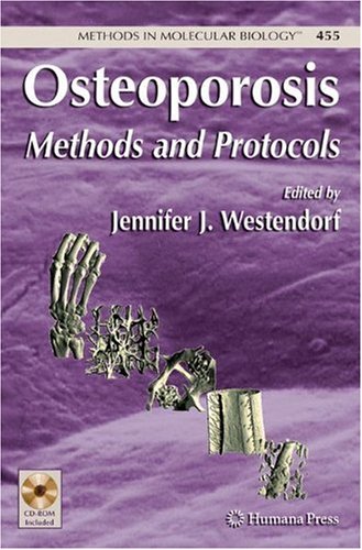 Osteoporosis