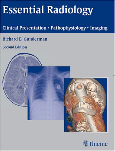 Essential Radiology: Clinical Presentation &middot; Pathophysiology &middot; Imaging