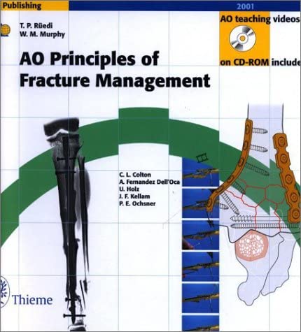 AO Principles of Fracture Management (Book with CD-ROMs + DVD)