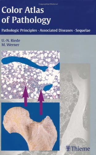 Color Atlas of Pathology