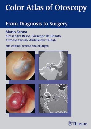 Color Atlas of Otoscopy: From Diagnosis to Surgery