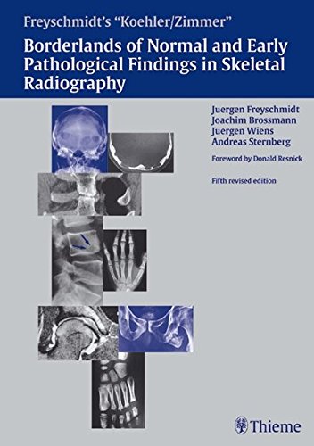 Koehler/Zimmer's Borderlands of Normal and Early Pathological Findings in Skeletal Radiography