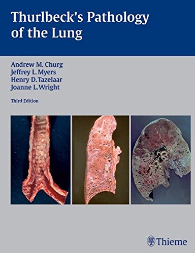 Thurlbeck's Pathology of the Lung