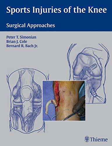 Sports Injuries of the Knee