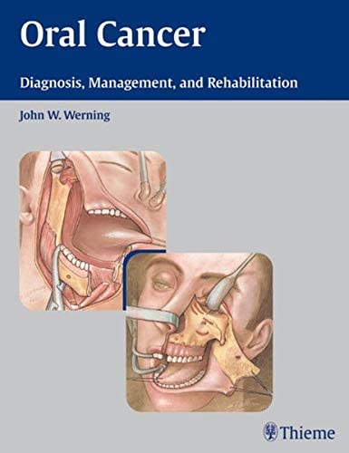 Oral Cancer: Diagnosis, Management, and Rehabilitation