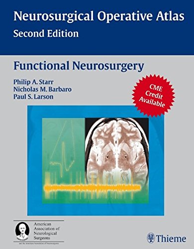 Functional Neurosurgery