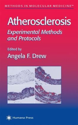 Atherosclerosis : experimental methods and protocols