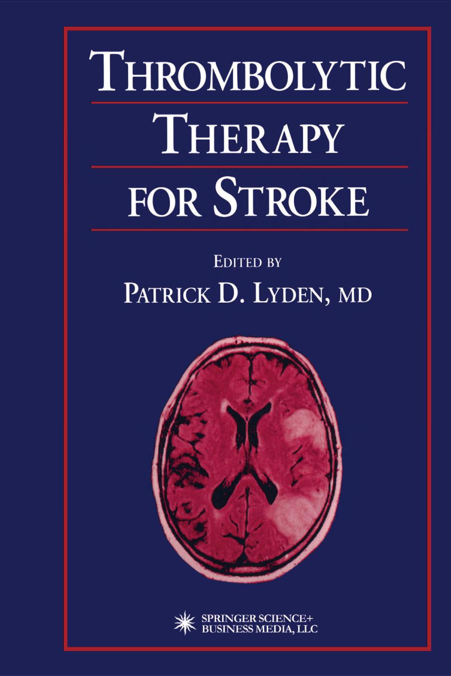 Thrombolytic therapy for stroke