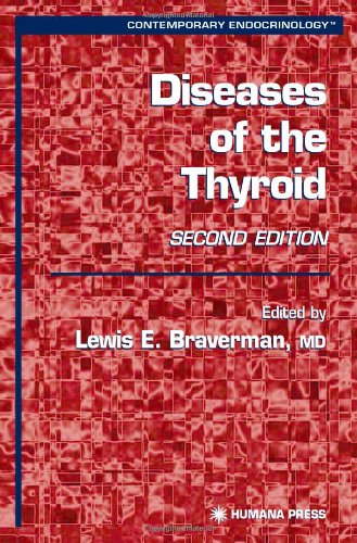 Diseases of the Thyroid