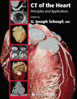 Ct Of The Heart