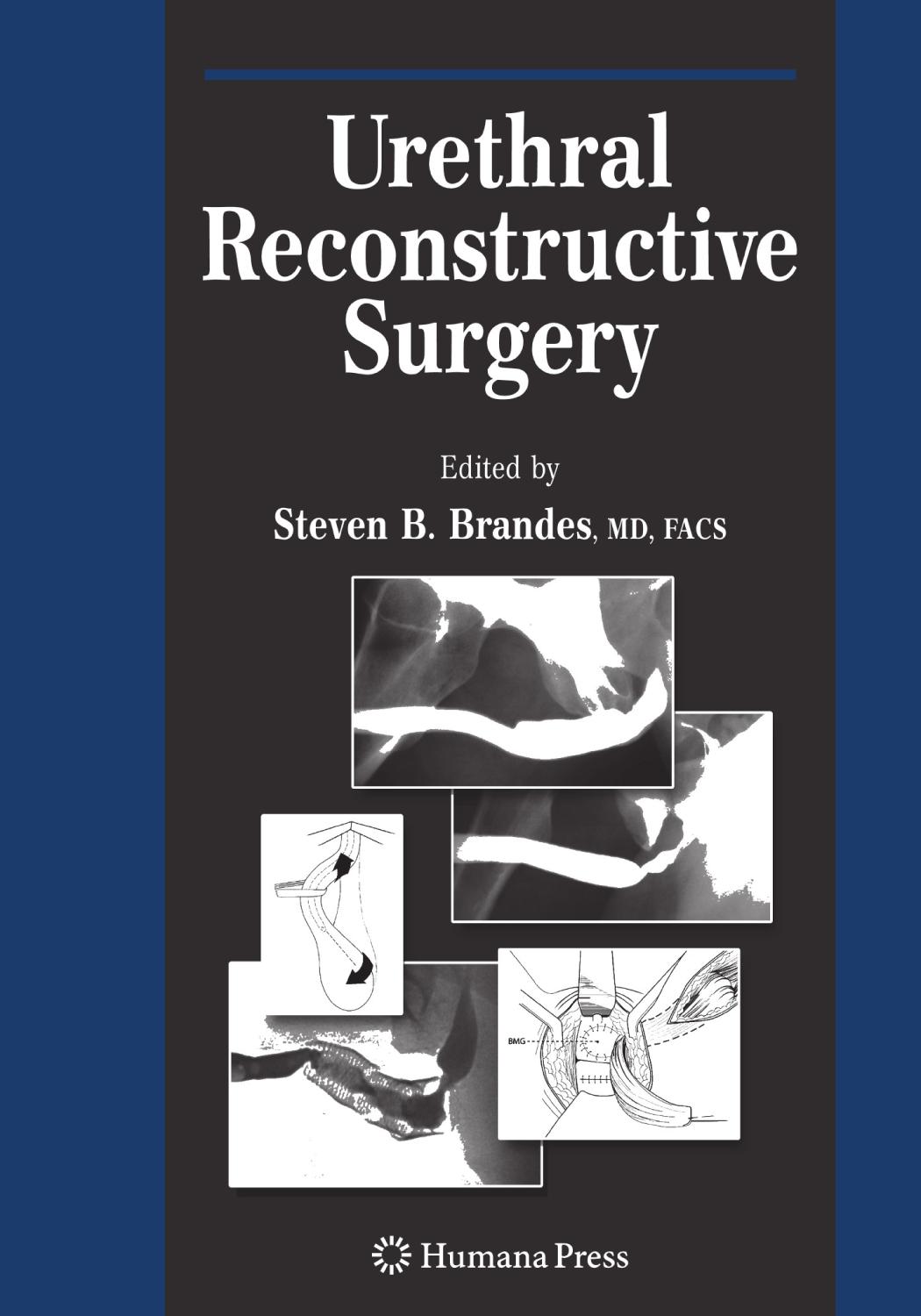 Urethral reconstructive surgery