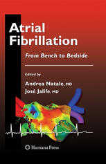 Atrial Fibrillation