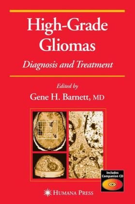 High-grade Gliomas