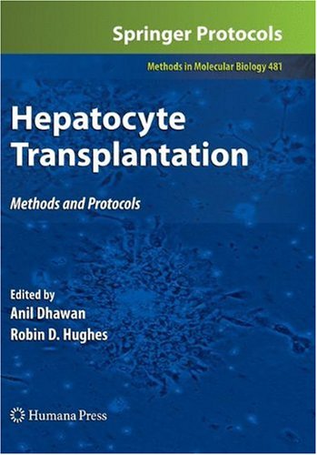 Hepatocyte Transplantation