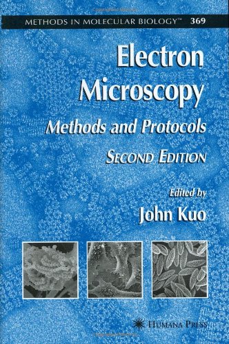 Electron Microscopy : Methods and Protocols.