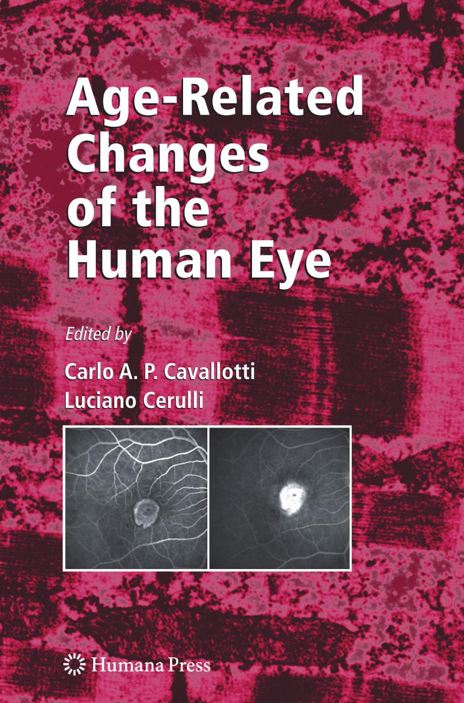 Age-related changes of the human eye