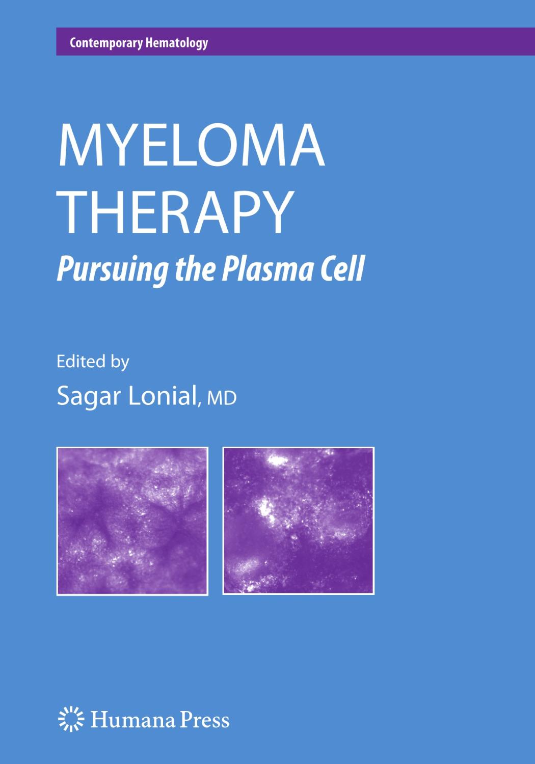 Myeloma Therapy