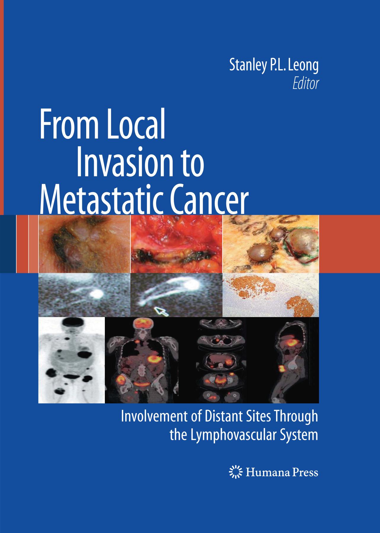 From Local Invasion to Metastatic Cancer
