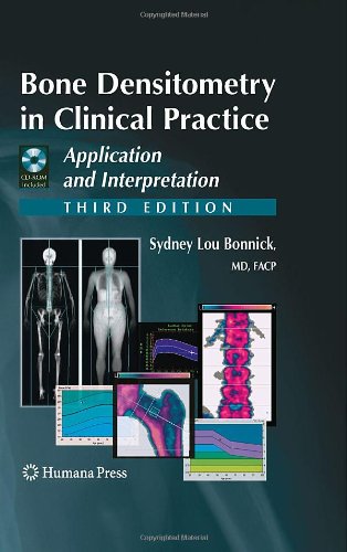 Bone Densitometry in Clinical Practice: Application and Interpretation (Current Clinical Practice)