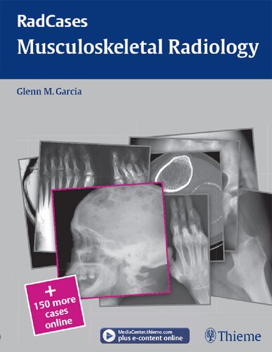 Radcases Musculoskeletal Radiology