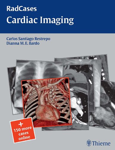 Cardiac Imaging