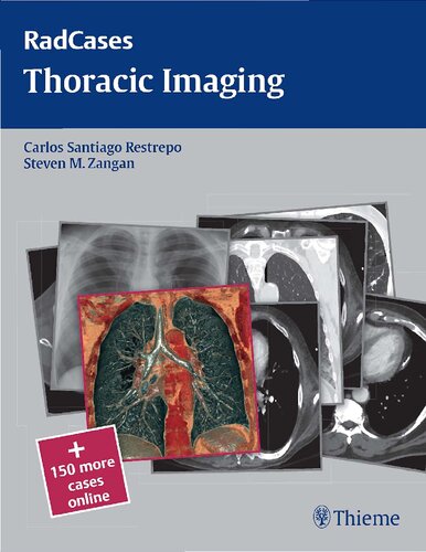 Thoracic Imaging