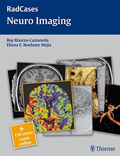 Neuro Imaging