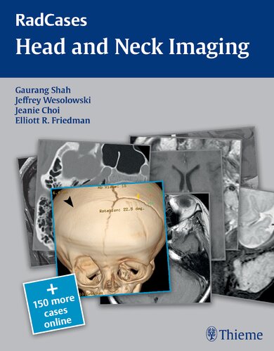 RadCases Head and Neck Imaging