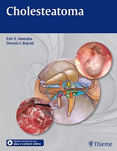 Cholesteatoma [With Access Code]