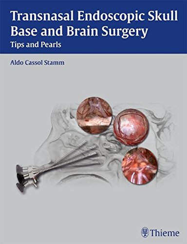 Transnasal Endoscopic Skull Base and Brain Surgery